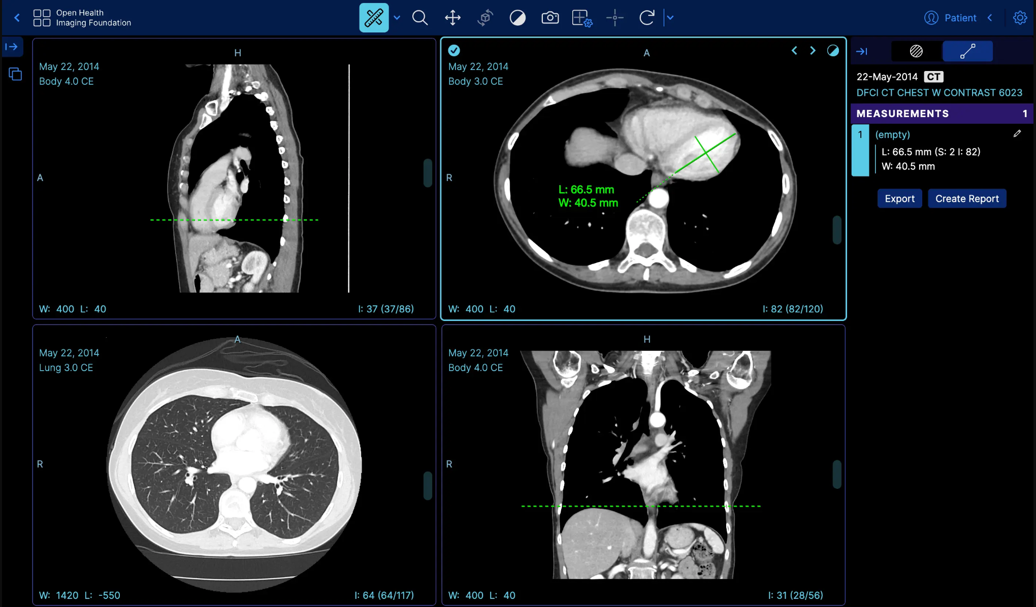 Seguimiento de mediciones